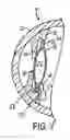 Fig. 08 - Intraocular lens adapted for accommodation via electrical signals