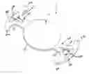 Fig. 01 - INTRAOCULAR LENS