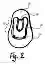 Fig. 03 - Apparatus for attachment of artificial nail