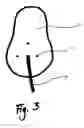Fig. 04 - Apparatus for attachment of artificial nail
