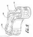Fig. 06 - Vertebral body replacement cage assembly