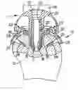 Fig. 01 - Attachment element for a prosthesis for the articulation of the shoulder