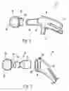 Fig. 02 - Orthopaedic implant sleeve and method
