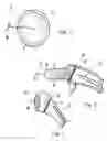 Fig. 03 - Orthopaedic implant sleeve and method
