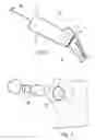 Fig. 04 - Orthopaedic implant sleeve and method