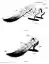 Fig. 08 - Prosthetic foot devices