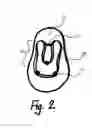 Fig. 03 - Method for attachment of artificial nail