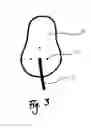 Fig. 04 - Method for attachment of artificial nail