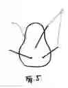 Fig. 06 - Method for attachment of artificial nail