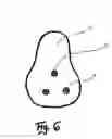 Fig. 07 - Method for attachment of artificial nail