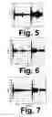 Fig. 06 - Noise reduction and estimation of pipeline signals