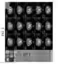Fig. 04 - METHOD AND APPARATUS FOR DIAGNOSTIC IMAGING ASSISTANCE