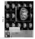 Fig. 06 - METHOD AND APPARATUS FOR DIAGNOSTIC IMAGING ASSISTANCE
