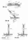 Fig. 03 - PATIENT IMMOBILIZATION DEVICE