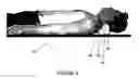 Fig. 03 - Orthotic device