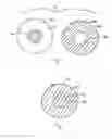 Fig. 05 - Indicator for identifying location of procedure