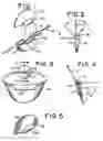 Fig. 02 - Apparatus for use in beauty salons