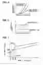 Fig. 04 - Exhaust emission control device for internal combustion engine