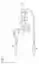 Fig. 02 - DUAL MOTORCYCLE EXHAUST SYSTEM