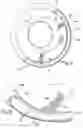 Fig. 04 - Device for a steering system, particularly for a motor vehicle