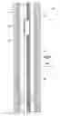 Fig. 02 - Single phase fluid sampling apparatus and method for use of same