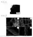 Fig. 06 - Metal nanoparticle with support, continuous metal nanoparticle body, and methods for producing these
