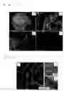 Fig. 07 - Metal nanoparticle with support, continuous metal nanoparticle body, and methods for producing these