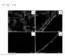 Fig. 08 - Metal nanoparticle with support, continuous metal nanoparticle body, and methods for producing these