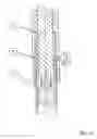 Fig. 04 - Device to guarantee the sequence of movement of at least two fluid-actuated displacement units