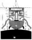 Fig. 06 - Non-lethal wireless stun projectile system for immobilizing a target by neuromuscular disruption