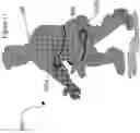 Fig. 12 - Non-lethal wireless stun projectile system for immobilizing a target by neuromuscular disruption