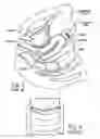 Fig. 02 - Extracting tool for cervical diaphragm