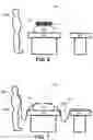 Fig. 06 - Surgical draping system