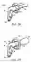 Fig. 10 - Offset stem for earplug and earplug formed therewith