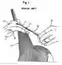 Fig. 02 - Hair-cutting method