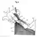 Fig. 05 - Hair-cutting method