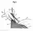 Fig. 06 - Hair-cutting method