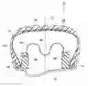 Fig. 01 - Run-flat tire support and manufacturing method for the same