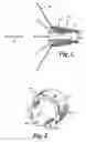 Fig. 02 - Crimp Hub for Anastomosis Device