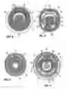 Fig. 06 - Intermediate and assembly assistance components for fluid driven tools and tools incorporating the same