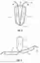 Fig. 05 - Easy open thermoformed package