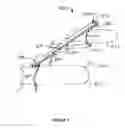 Fig. 09 - Adjustable strap mounting system