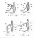 Fig. 07 - Hook/hanger component mounting systems, components thereof, and related methods