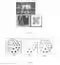 Fig. 07 - Combined PET/MR imaging system and APD-based pet detector for use in simultaneous PET/MR imaging