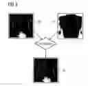 Fig. 03 - Diagnosis device and diagnosis method for radiographic and nuclear medical examinations