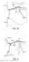 Fig. 03 - Offset mold twinning