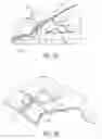 Fig. 06 - Offset mold twinning
