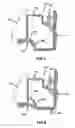 Fig. 04 - Unitized pinion seal for an axle