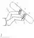 Fig. 02 - Snowboard Back Foot Support Apparatus