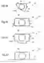 Fig. 04 - Vehicle body structure reinforced against side impact